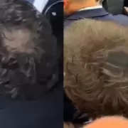 Milei apareci� en la ONU con la cabeza pintada para ocultar su pelada: los otros "cuidados" en la imagen presidencial