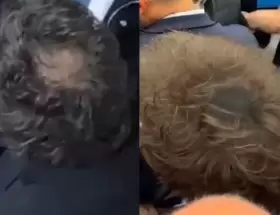 Antes y despu�s, o Javier Milei con pelada y sin pelada.