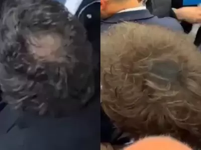 Antes y despu�s, o Javier Milei con pelada y sin pelada.