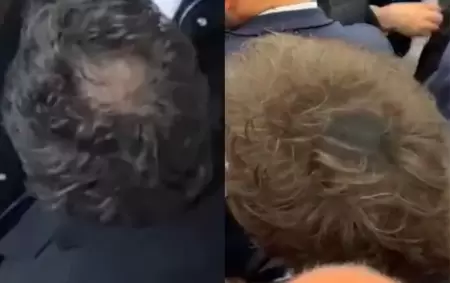 Antes y despu�s, o Javier Milei con pelada y sin pelada.