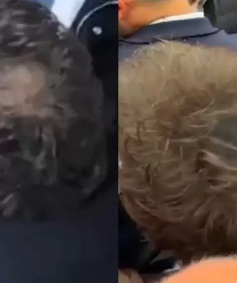 Antes y despu�s, o Javier Milei con pelada y sin pelada.