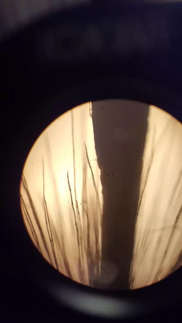 Los plátanos de sombra actúan irritando las fosas nasales, las vías respiratorias y los ojos (visión con microscopio)