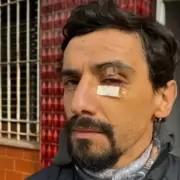 Robo en La Plata: reconoci� a su hijo en el video del asalto y pidi� que lo detengan