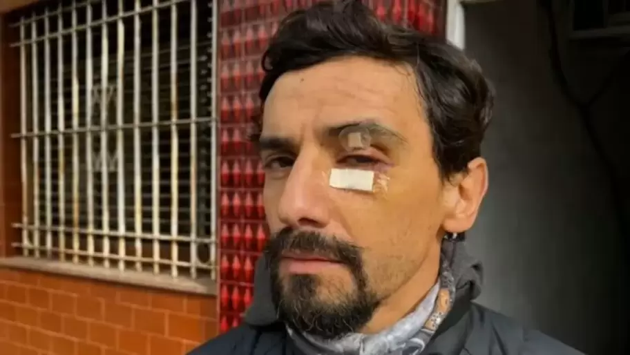 La víctima fue atendida de urgencia