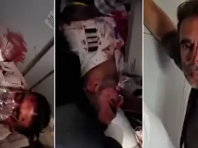 Las im�genes del copiloto ensangrentado