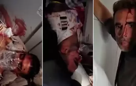 Las im�genes del copiloto ensangrentado