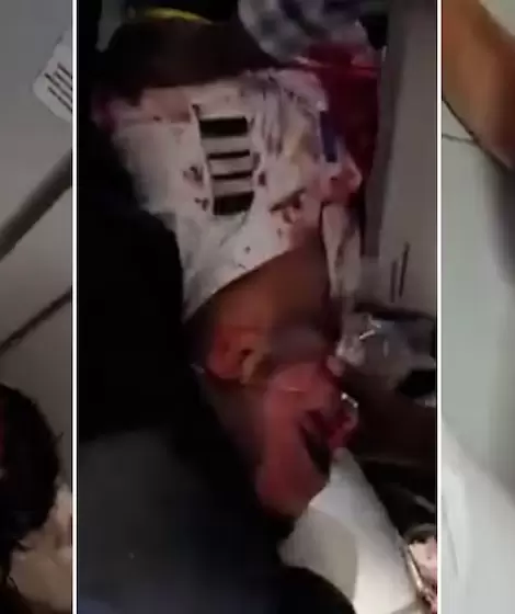 Las im�genes del copiloto ensangrentado