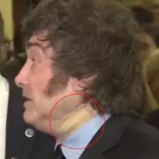 Preocupa la salud de Milei: vendaje en el cuello, hinchazón y moretón