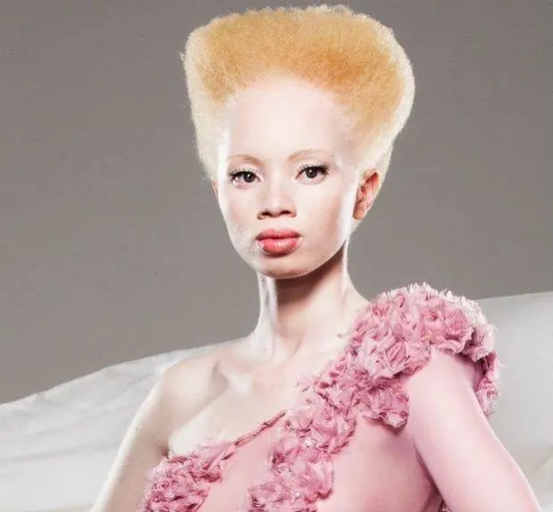 Thando Hopa, luchadora por los derechos de los albinos.
