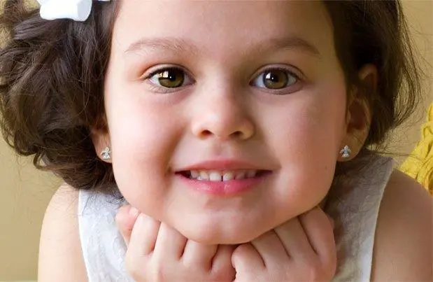 A algunas nenas se los perforan cuando crecen