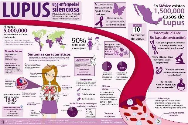 Lupus